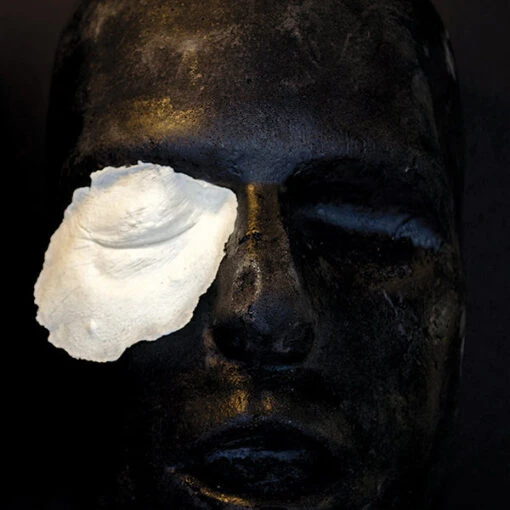 Right Swollen Shut Eye And Cheek #155