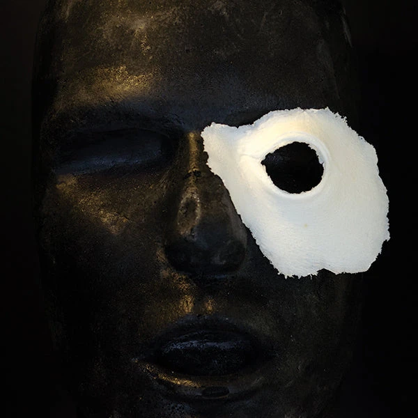 Left Swollen Eye And Cheek #156 3 Left Swollen Eye And Cheek #156