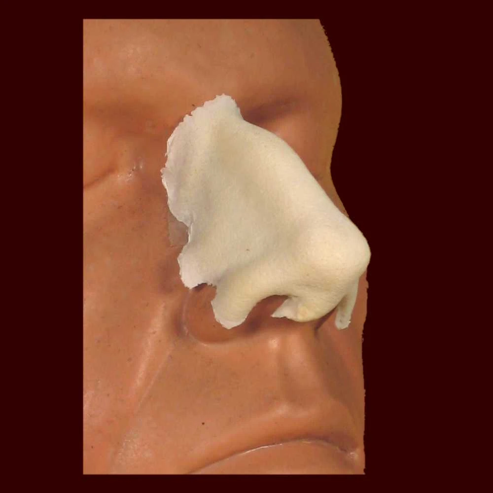 Aquiline Nose Appliance Standard Size 3 Aquiline Nose Appliance Standard Size