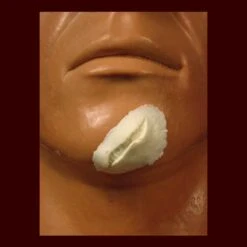 Sm. Split/cut Chin