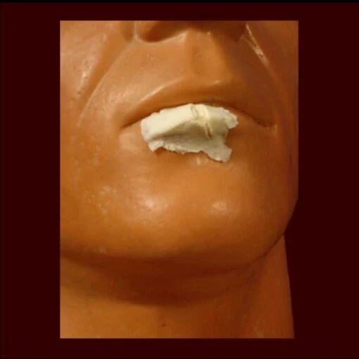 Sm. Split/cut Lip