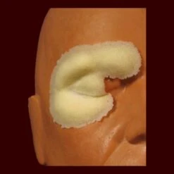 Right Or Left Swollen Cheek