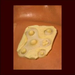 Warts Moles Pimples