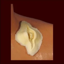 Deep Bone Gash