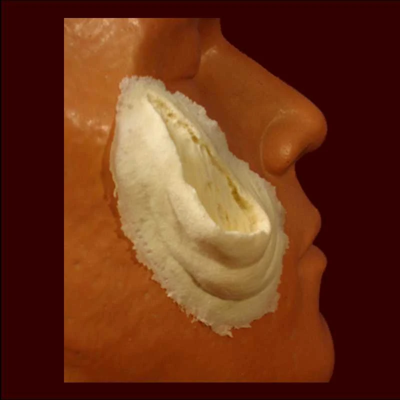 Lg. Skin Gouge 3 Lg. Skin Gouge