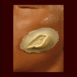 Sm. Skin Gouge