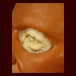 Right Or Left Gouged Eye