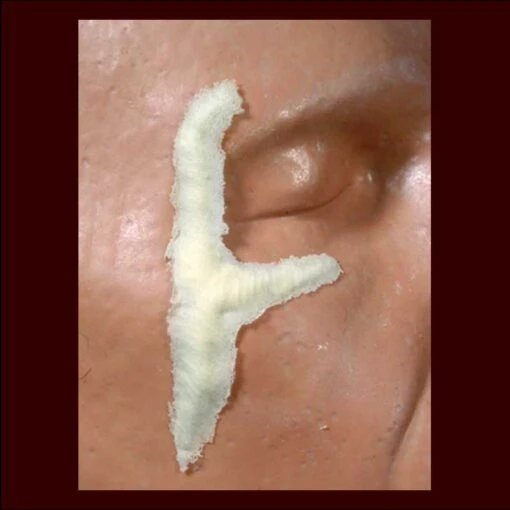 Y Scar