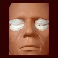 Aging Eye Lids & Bags
