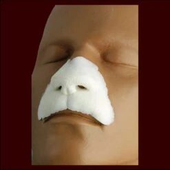 Leonine Nose