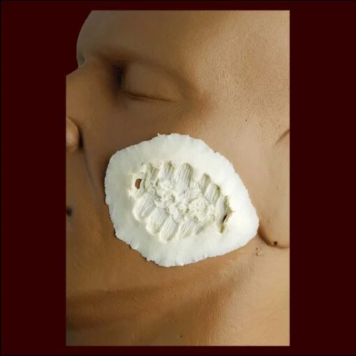 Bite Mark 2