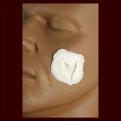 Deep Triangle Wound - Small