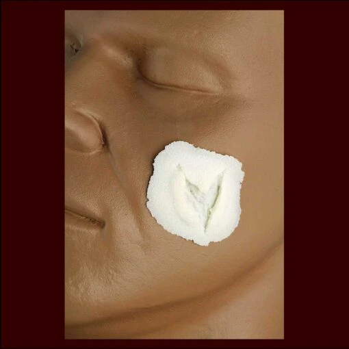Deep Triangle Wound - Small