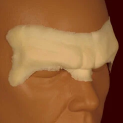 Stern Brow Appliance