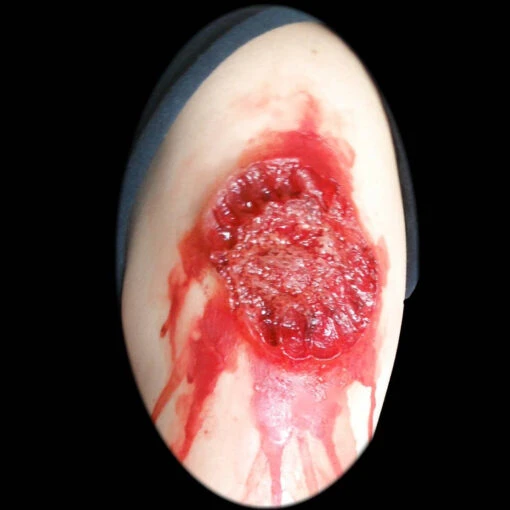 Soul Food (Bite Wound) - Image 2